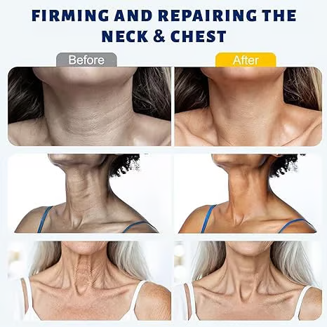 Roller Massage Neck Cream 🧴 Collagen & Hyaluronic Acid | Firms Neck, Reduces Wrinkles & Double Chin-8POP
