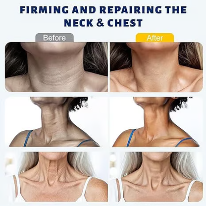 Roller Massage Neck Cream 🧴 Collagen & Hyaluronic Acid | Firms Neck, Reduces Wrinkles & Double Chin-8POP