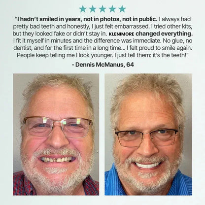 🔥Up to 70% off today only!🔥Dilyhbu Medical Full Denture with Strong Suctiond🦷Obtain American Dental Association (ADA) Certification-8POP