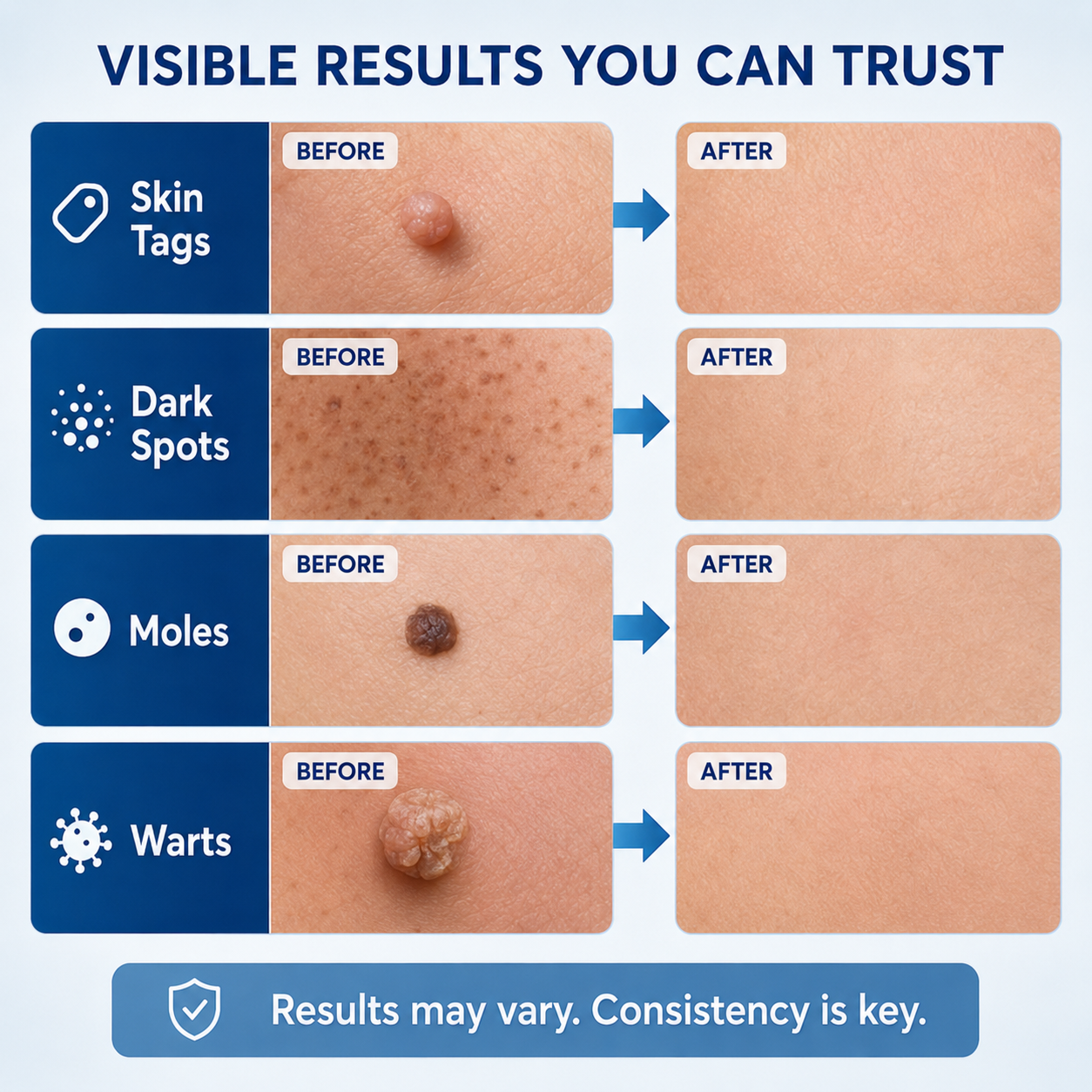 🔥7-Day Skin Tag & Spot Care Eraser✨Painless &Scar-Free💙Treatment for Dark Spots & Skin Imperfections-8JX3