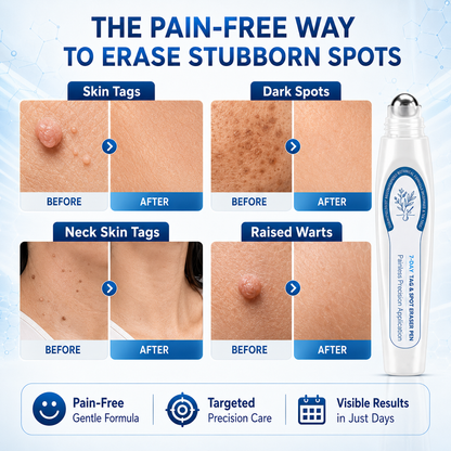 🔥7-Day Skin Tag & Spot Care Eraser✨Painless &Scar-Free💙Treatment for Dark Spots & Skin Imperfections-8JX3