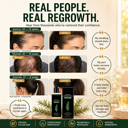 🔥50% OFF| Rosemary Hydrolyzed Keratin Shampoo🌿Deep Nourishing Repair Shampoo, Moisturizing Treatment for Dry, Frizzy & Damaged Hair💇‍♀️-8HJ9