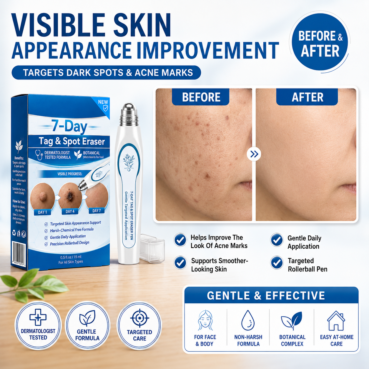 🔥7-Day Skin Tag & Spot Care Eraser✨Painless &Scar-Free💙Treatment for Dark Spots & Skin Imperfections-8JX3