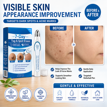🔥7-Day Skin Tag & Spot Care Eraser✨Painless &Scar-Free💙Treatment for Dark Spots & Skin Imperfections-8JX3