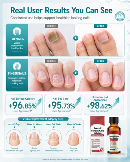 🔥50% OFF🦶Toenail Care Solution | Advanced Herbal Formula for Thick, Yellow, Cracked & Brittle Nails-8YF7