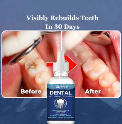 🦷🦷🦷Tooth Armor: Nano-Hydroxyapatite   Drops for Cavity Defense