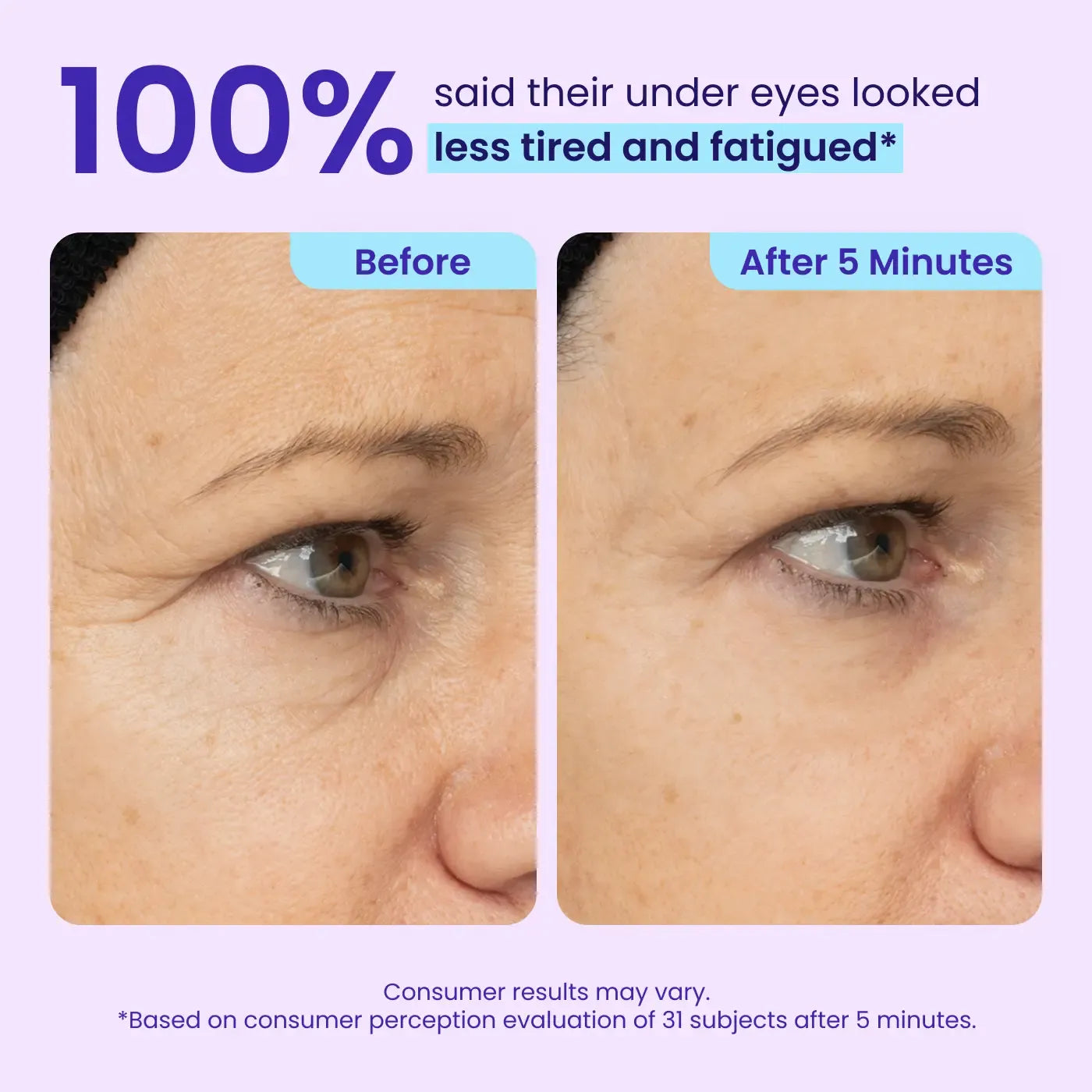 👀👀Eye Bag Instant Eraser, Tightens, Firms, & Blurs Wrinkles-8POP