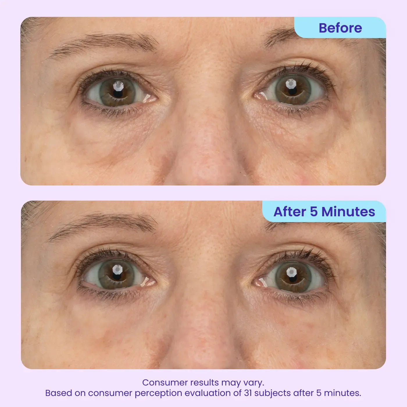 👀👀Eye Bag Instant Eraser, Tightens, Firms, & Blurs Wrinkles-8POP