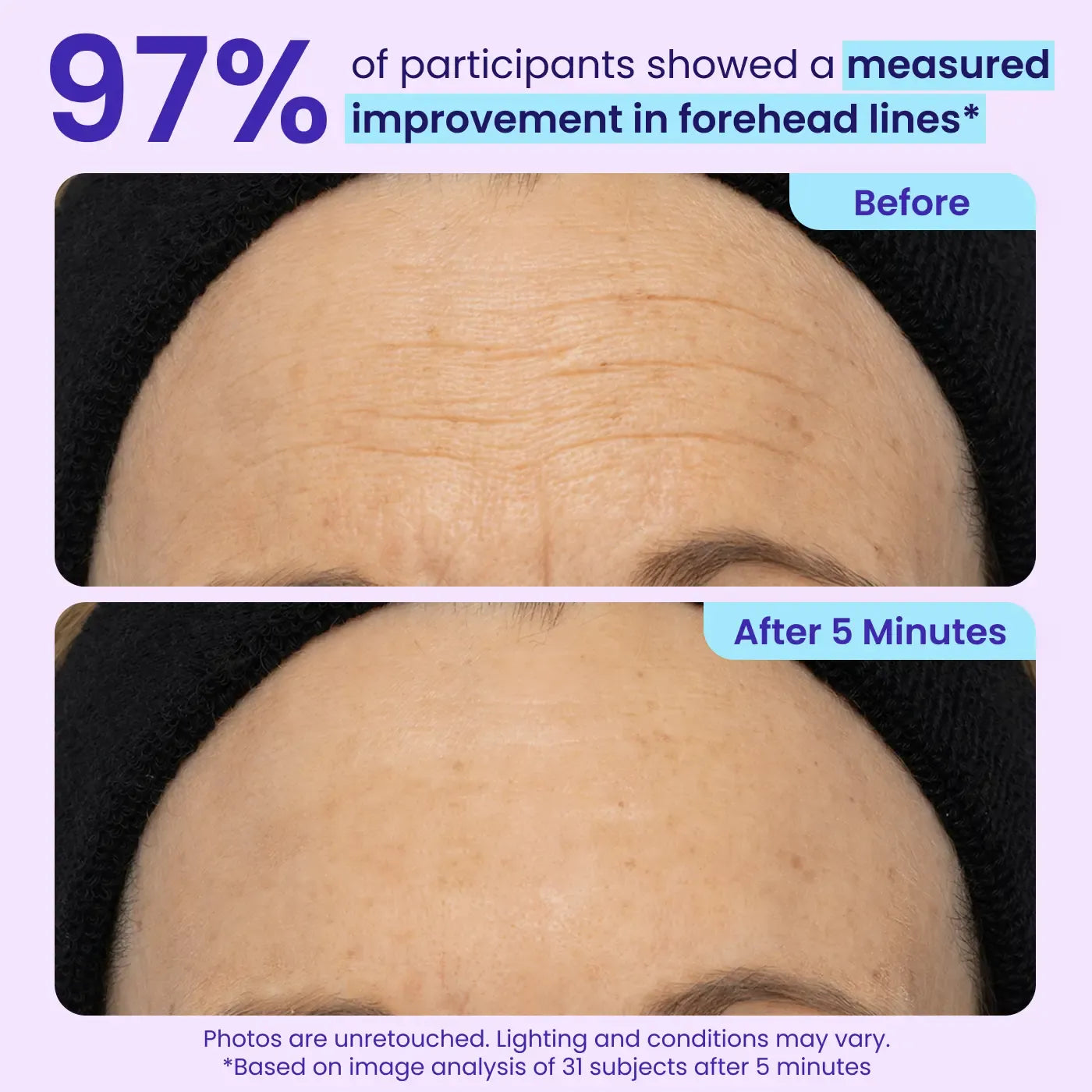 👀👀Eye Bag Instant Eraser, Tightens, Firms, & Blurs Wrinkles-8POP